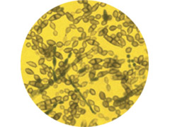 Mold Spores